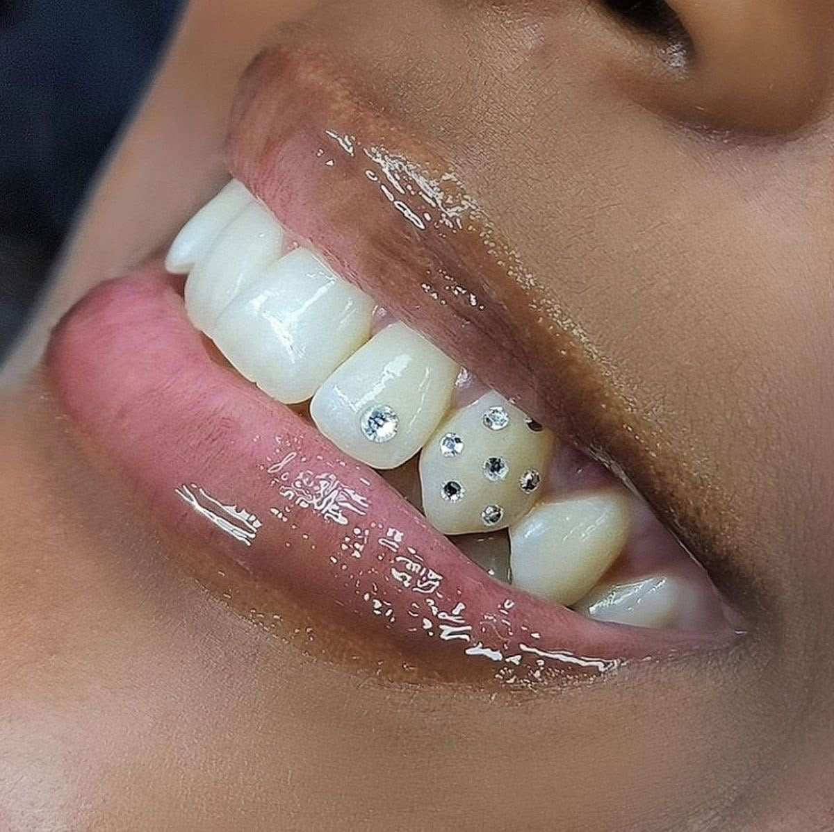 Tooth gem kit classic