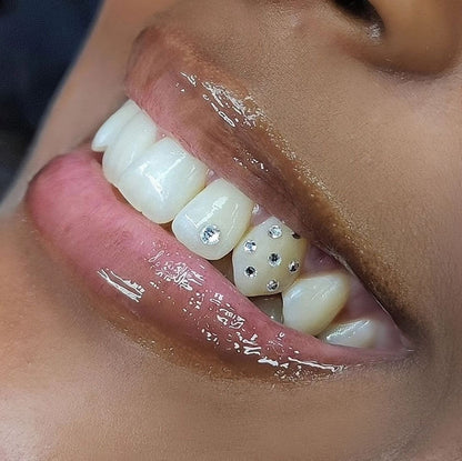 Tooth gem kit classic