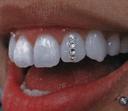 Tooth gem kit classic