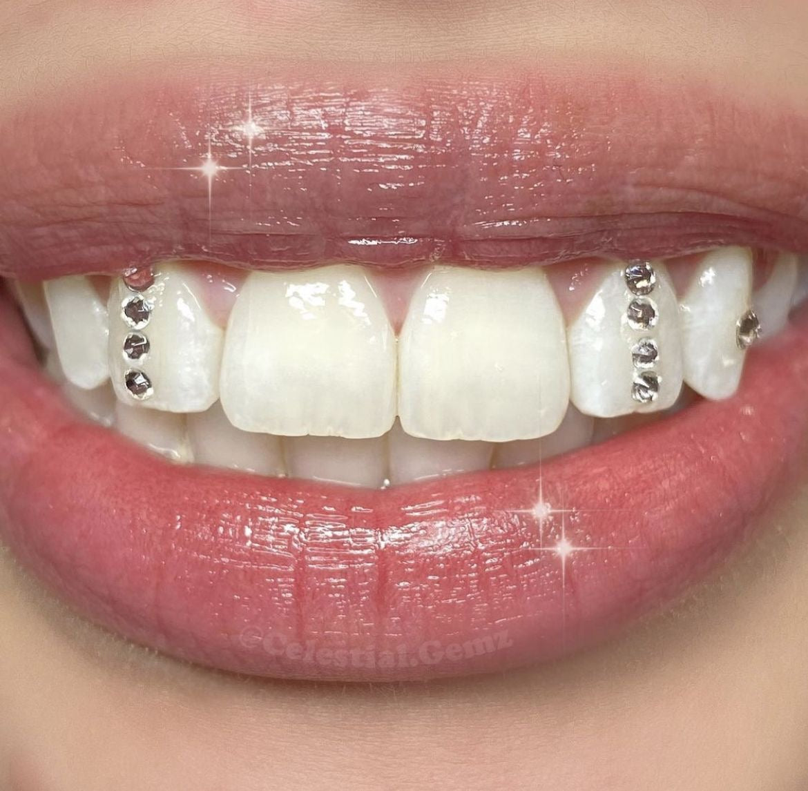 Tooth gem kit classic