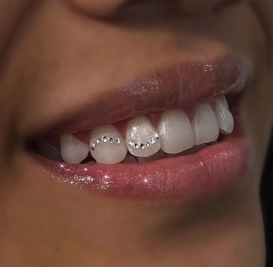 Tooth gem kit classic